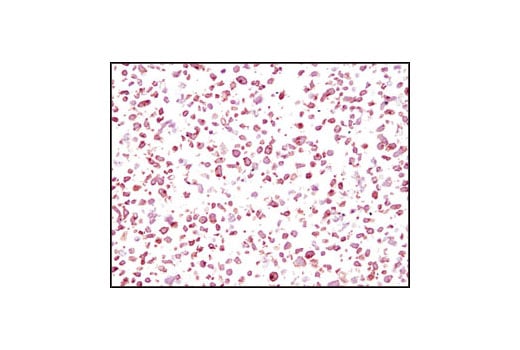 Immunohistochemistry Image 2: FGF Receptor 3 (C51F2) Rabbit Monoclonal Antibody (BSA and Azide Free)