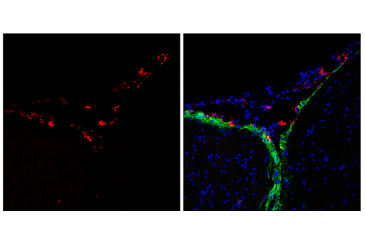 Immunofluorescence Image 1: p22phox (E7Y1F) Rabbit Monoclonal Antibody (BSA and Azide Free)
