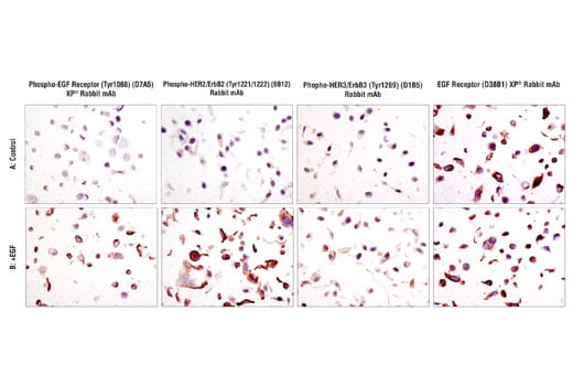 undefined Image 2: SignalSlide<sup>®</sup> Phospho-ErbB Family IHC Controls