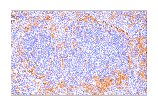 Immunohistochemistry Image 4: SLP-76 (E4N7E) Rabbit Monoclonal Antibody