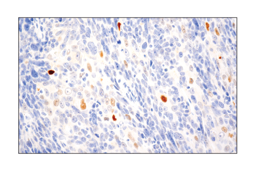 Immunohistochemistry Image 2: PRAME (E7I1B) Rabbit Monoclonal Antibody