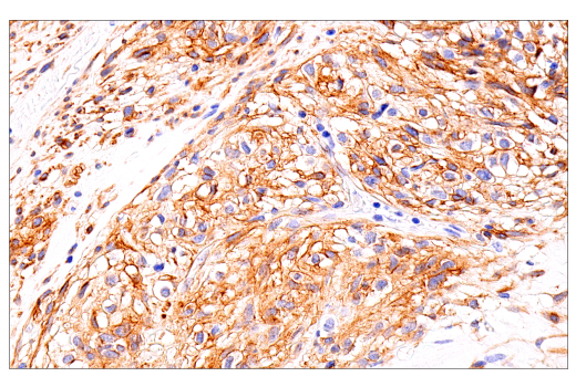Immunohistochemistry Image 1: DOG1/Anoctamin 1 (K9) Mouse Monoclonal Antibody
