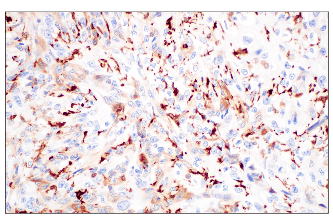 Immunohistochemistry Image 3: FTL (F9O4I) Rabbit Monoclonal Antibody