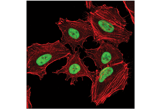 Immunofluorescence Image 1: YY1 (D5D9Z) Rabbit Monoclonal Antibody