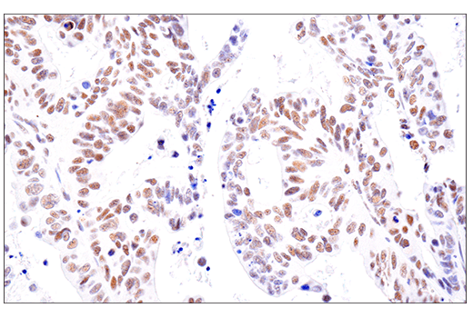 Immunohistochemistry Image 4: SETD2 (E4W8Q) Rabbit Monoclonal Antibody (IHC Formulated)
