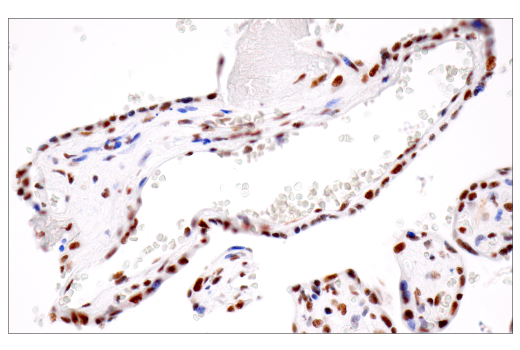Immunohistochemistry Image 7: CPSF4 (E2L2Z) Rabbit Monoclonal Antibody