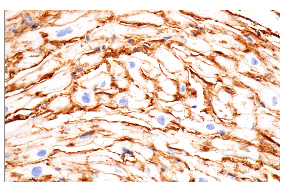 Immunohistochemistry Image 10: Vitronectin (F8D3L) Rabbit Monoclonal Antibody