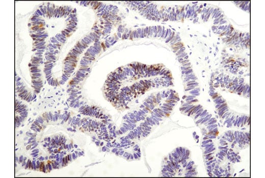 Immunohistochemistry Image 1: Wee1 (D10D2) Rabbit Monoclonal Antibody