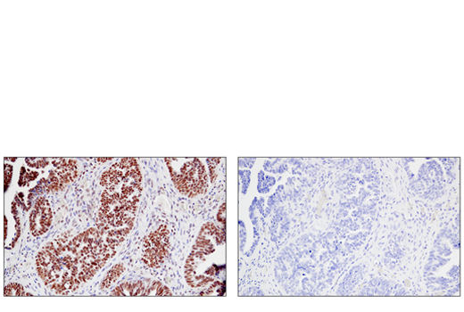 Immunohistochemistry Image 4: JMJD6 (D3O3N) Rabbit Monoclonal Antibody