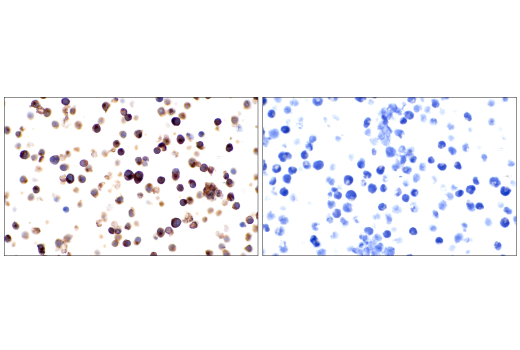 Immunohistochemistry Image 5: TRBC1/TCR beta constant region 1 (E6Z3S) Rabbit Monoclonal Antibody (BSA and Azide Free)