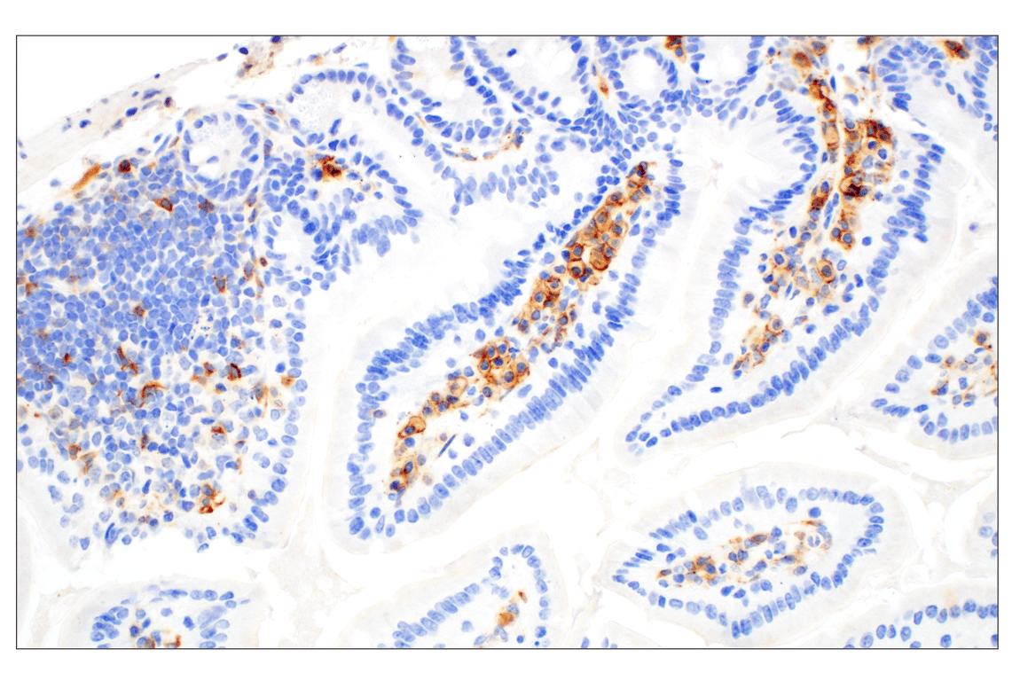 Immunohistochemistry Image 5: CD28 (D2Z4E) Rabbit Monoclonal Antibody (BSA and Azide Free)