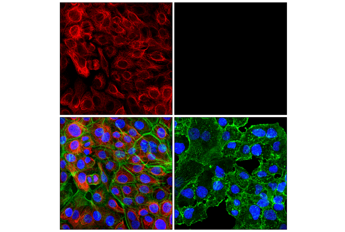 Immunofluorescence Image 1: Keratin 5 (E2T4B) Rabbit Monoclonal Antibody (Alexa Fluor<sup>®</sup> 555 Conjugate)