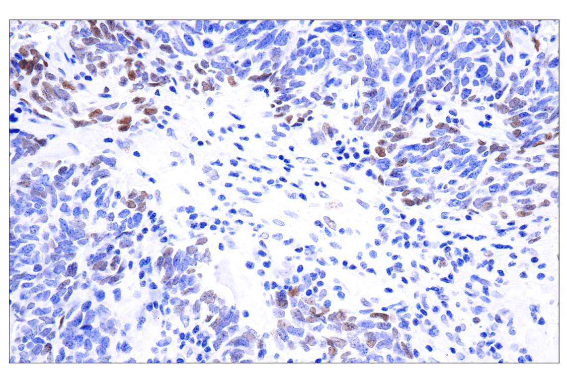 Immunohistochemistry Image 2: Phospho-Stat3 (Tyr705) (D3A7) XP<sup>®</sup> Rabbit mAb (BSA and Azide Free)