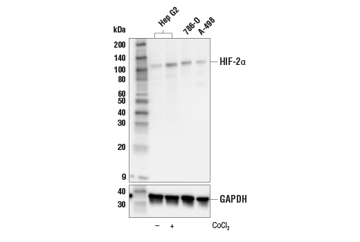 Western Blotting Image 2: HIF-2 alpha (E8E5Z) Rabbit Monoclonal Antibody