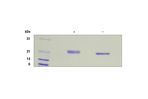 undefined Image 2: Human IL-6 Recombinant Protein