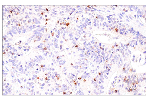 Immunohistochemistry Image 1: CCL5/RANTES (E9S2K) Rabbit Monoclonal Antibody