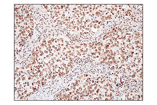 Immunohistochemistry Image 2: SS18 (D6I4Z) Rabbit Monoclonal Antibody (BSA and Azide Free)