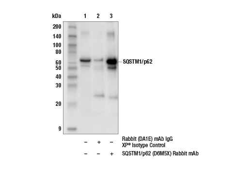 Immunoprecipitation Image 1: SQSTM1/p62 (D6M5X) Rabbit Monoclonal Antibody