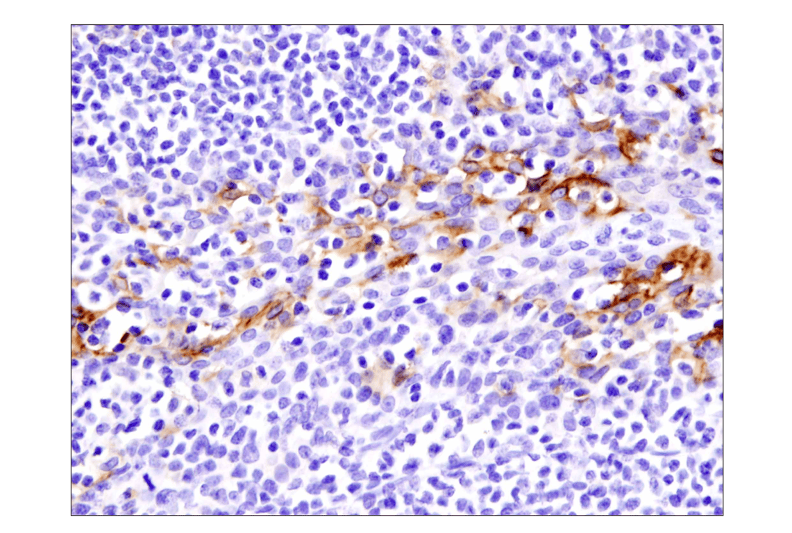 Immunohistochemistry Image 3: PD-L1 (Extracellular Domain Specific) (E1J2J<sup>™</sup>) Rabbit Monoclonal Antibody (BSA and Azide Free)