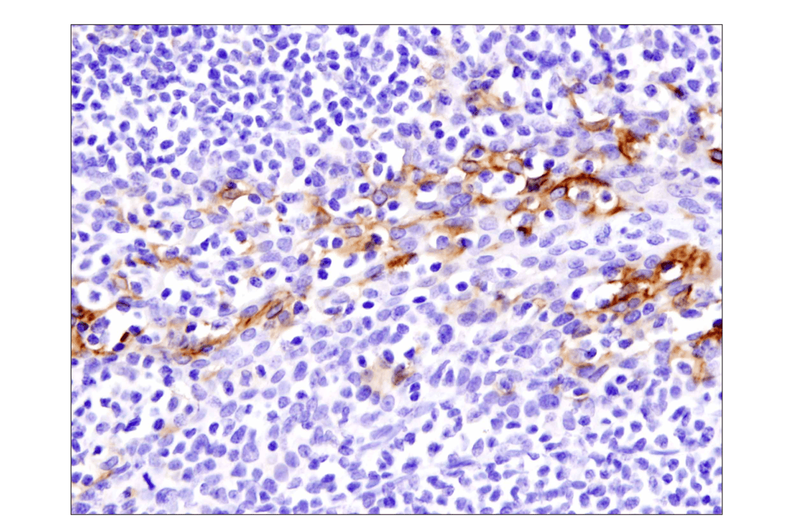 Immunohistochemistry Image 3: PD-L1 (Extracellular Domain Specific) (E1J2J<sup>™</sup>) Rabbit mAb (BSA and Azide Free)