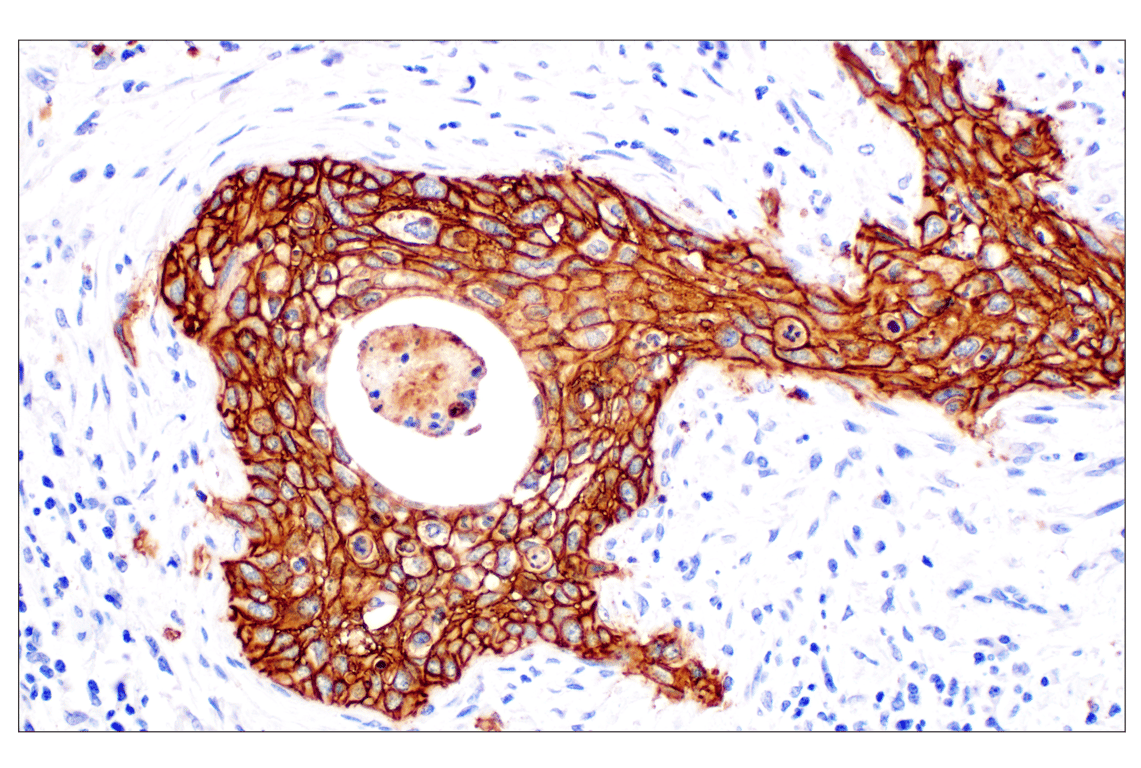 Immunohistochemistry Image 1: TACSTD2/TROP2 (F4W4J) Rabbit Monoclonal Antibody