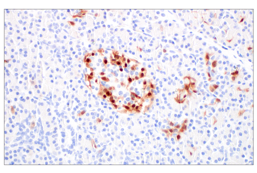 Immunohistochemistry Image 8: p16 INK4A (BC42) Mouse Monoclonal Antibody