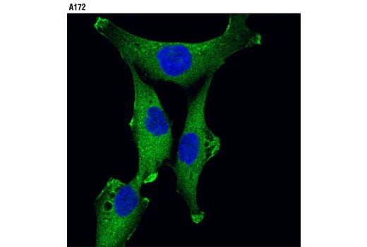Immunofluorescence Image 2: JIP4/SPAG9 (D72F4) Rabbit Monoclonal Antibody (BSA and Azide Free)