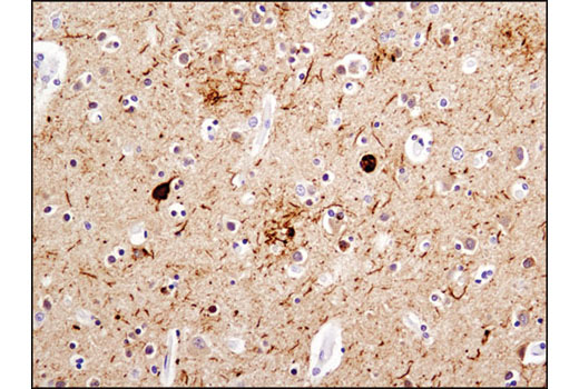 Immunohistochemistry Image 1: Phospho-Tau (Thr181) (D9F4G) Rabbit Monoclonal Antibody (BSA and Azide Free)