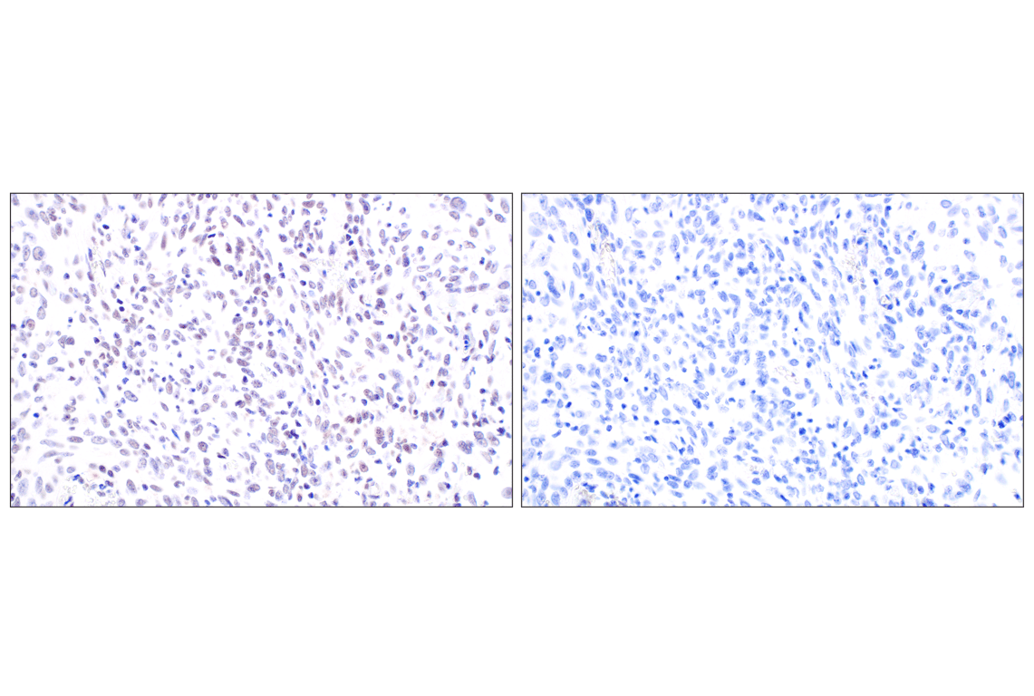 Immunohistochemistry Image 9: MDM2 (F7W7X) Rabbit Monoclonal Antibody