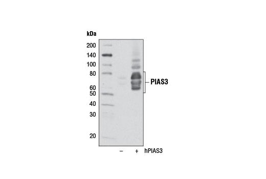 undefined Image 14: Jak/Stat Pathway Inhibitors Antibody Sampler Kit