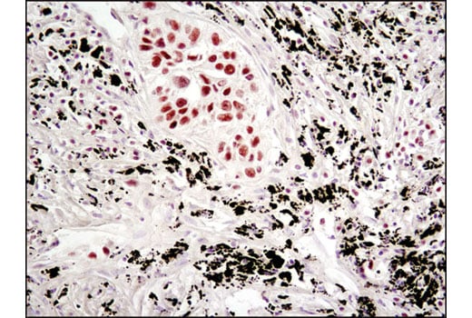 Immunohistochemistry Image 1: Bmi1 (D20B7) Rabbit Monoclonal Antibody