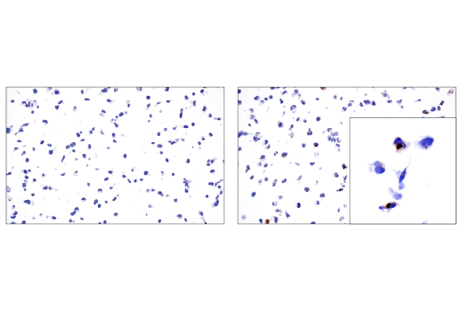 undefined Image 26: p62/KEAP1/NRF2 Pathway Antibody Sampler Kit