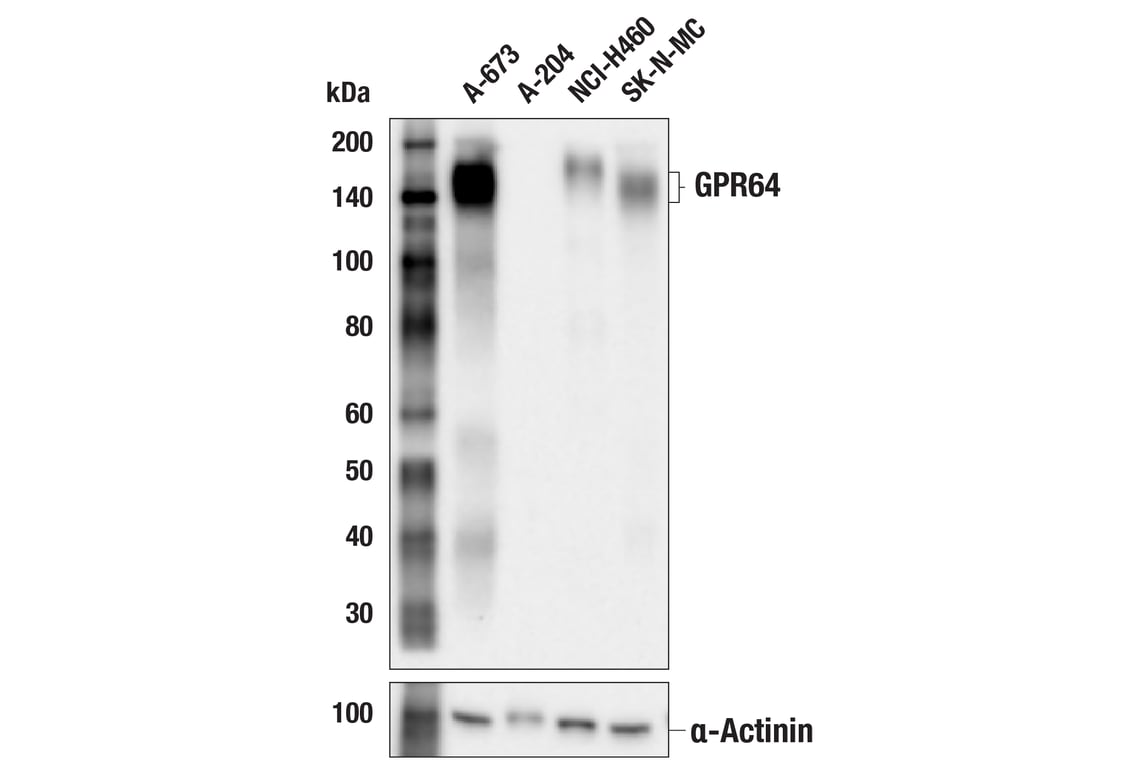 Western Blotting Image 2: GPR64 (E9D4X) Rabbit Monoclonal Antibody