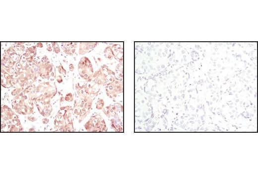 Immunohistochemistry Image 1: Akt (pan) (11E7) Rabbit Monoclonal Antibody (BSA and Azide Free)