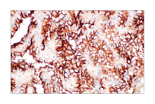Immunohistochemistry Image 1: ACE2 (OTI1G4) Mouse Monoclonal Antibody
