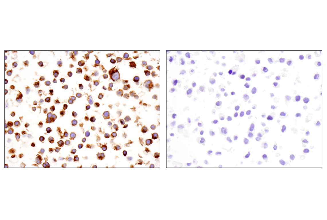 Immunohistochemistry Image 13: TNFRSF17/BCMA (E6D7B) Rabbit Monoclonal Antibody