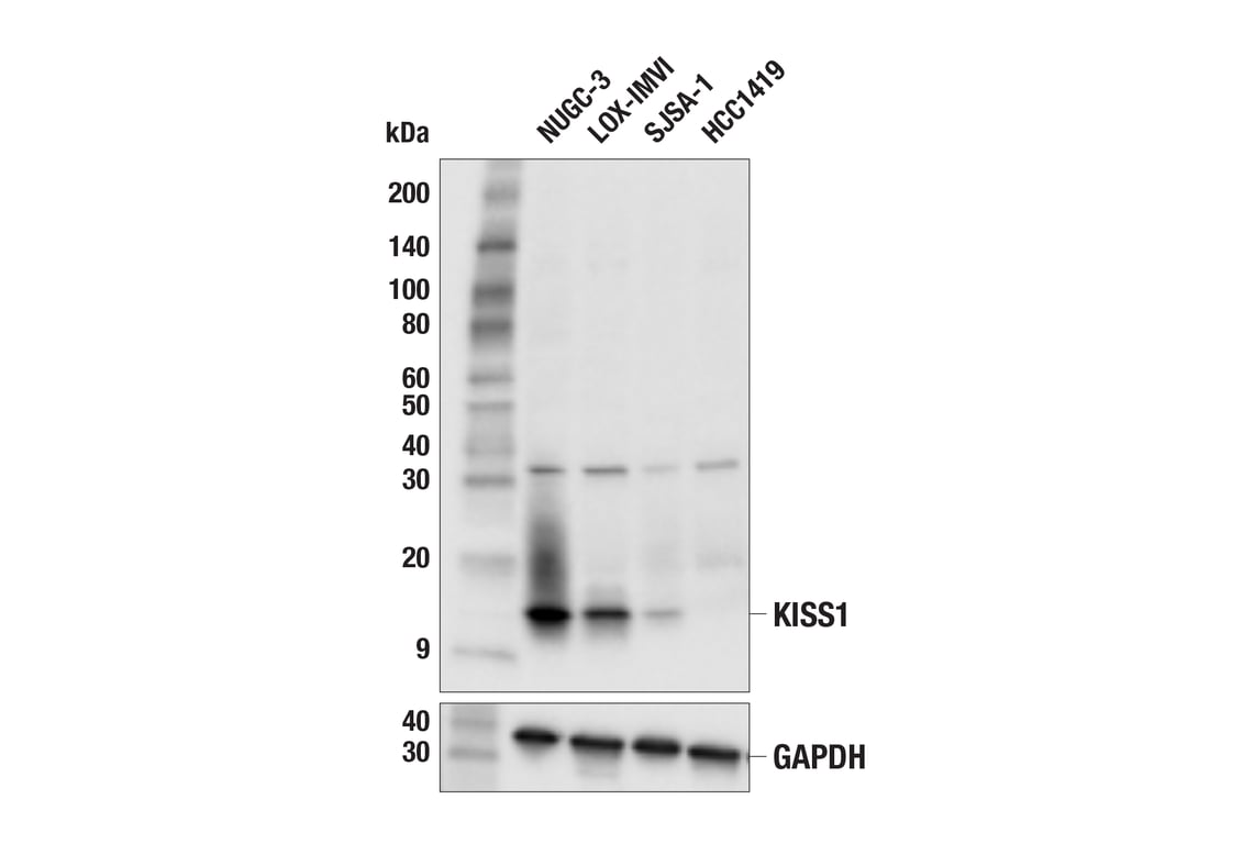 Western Blotting Image 2: KISS1 (E6H9S) Rabbit Monoclonal Antibody