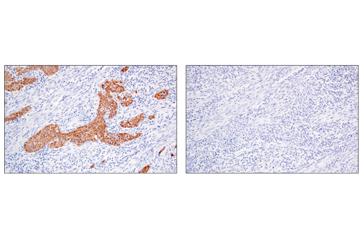 Immunohistochemistry Image 4: MAGE-A4 (E7O1U) Rabbit Monoclonal Antibody (BSA and Azide Free)