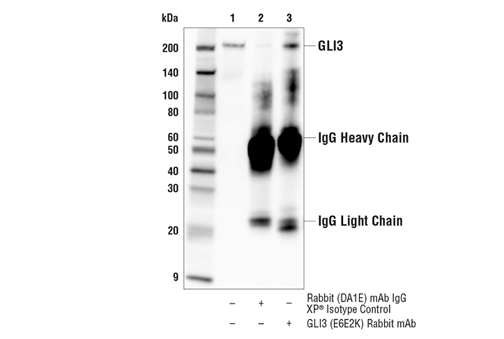 undefined Image 14: Hedgehog Signaling Antibody Sampler Kit
