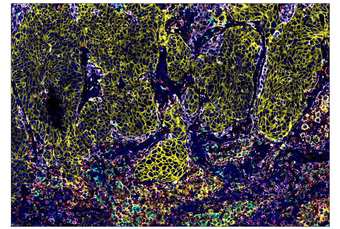 Immunohistochemistry Image 1: HLA-DRA (E9R2Q) & CO-0023-594 SignalStar<sup>™</sup> Oligo-Antibody Pair