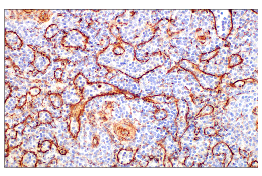 Immunohistochemistry Image 3: Nestin (E4O9E) Rabbit Monoclonal Antibody