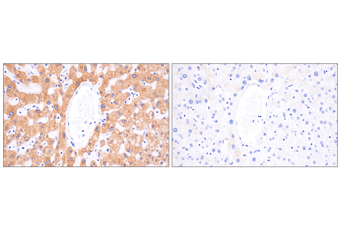 Immunohistochemistry Image 9: MGST1 (F6F5T) Rabbit Monoclonal Antibody