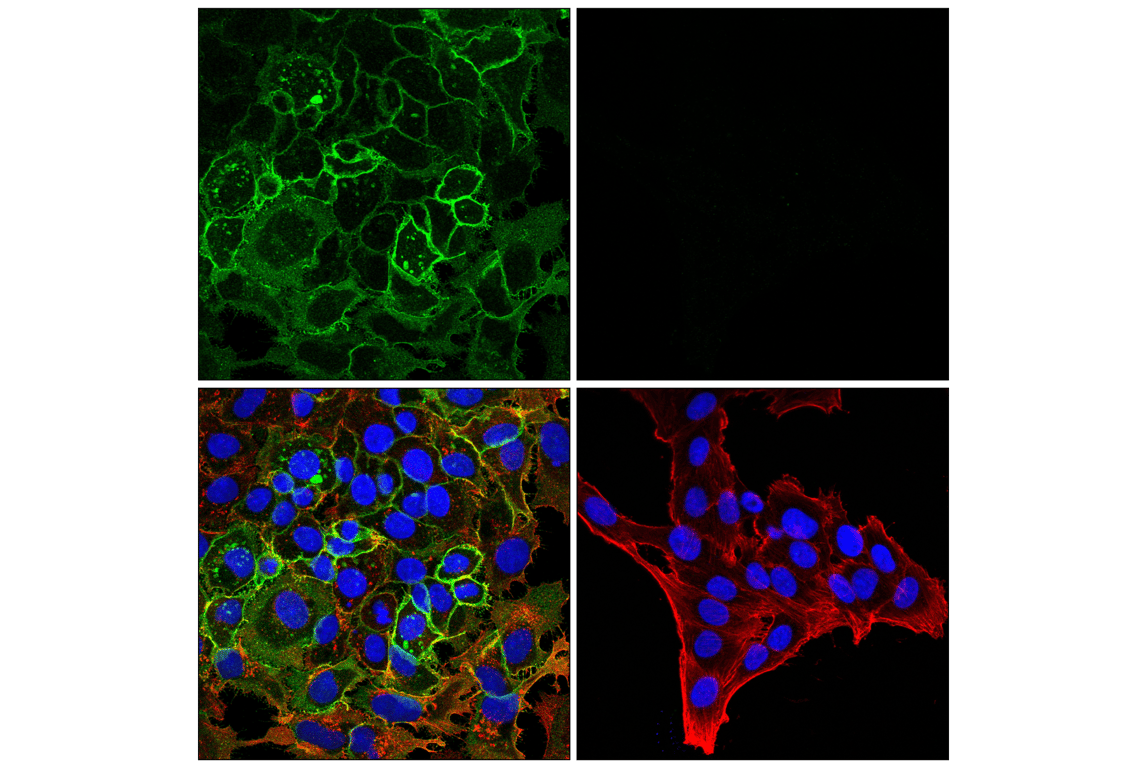 Immunofluorescence Image 1: ENPP1 (E3R8O) Rabbit Monoclonal Antibody