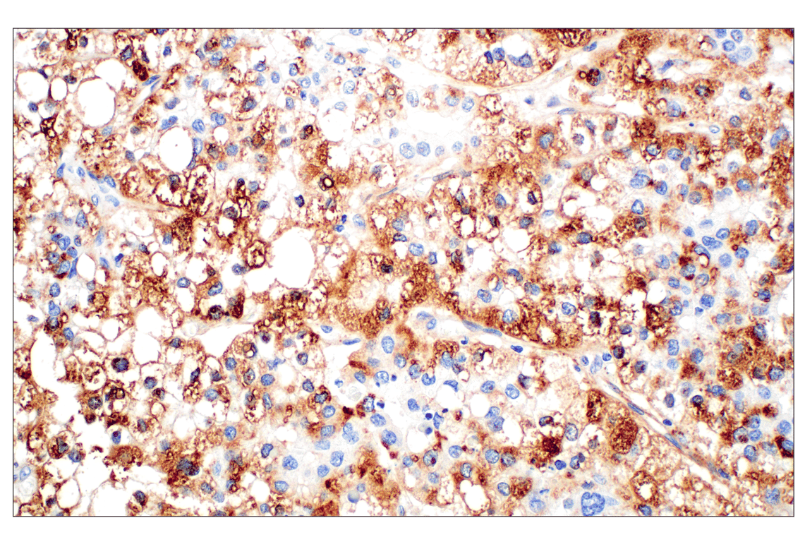 Immunohistochemistry Image 7: Perilipin-2 (E6G6M) Rabbit Monoclonal Antibody