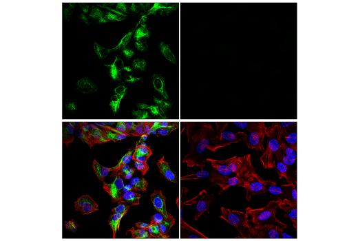 Immunofluorescence Image 1: Neurofilament-M (E7L2T) Rabbit Monoclonal Antibody