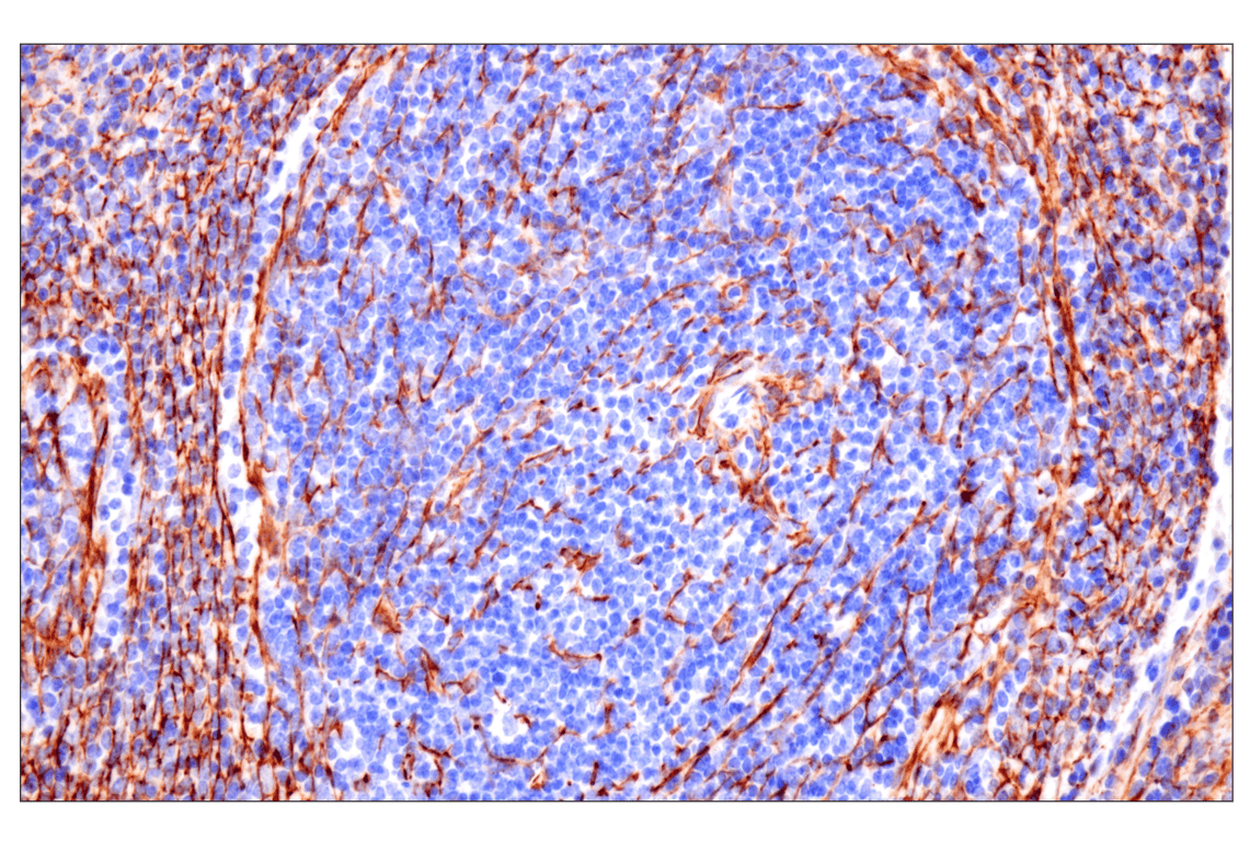Immunohistochemistry Image 14: Desmin (F5V4I) Rabbit Monoclonal Antibody (BSA and Azide Free)
