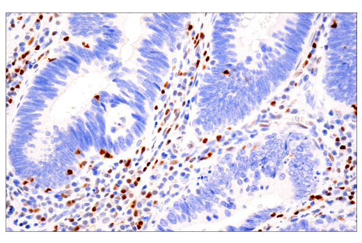Immunohistochemistry Image 1: Tox/Tox2 (E6I3Q) Rabbit Monoclonal Antibody