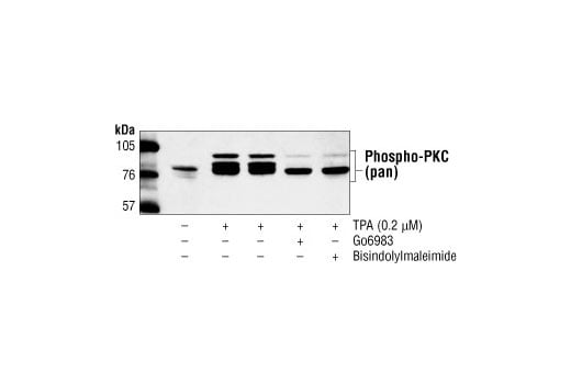 Western Blotting Image 2: Phospho-PKC (pan) (beta II Ser660) Antibody