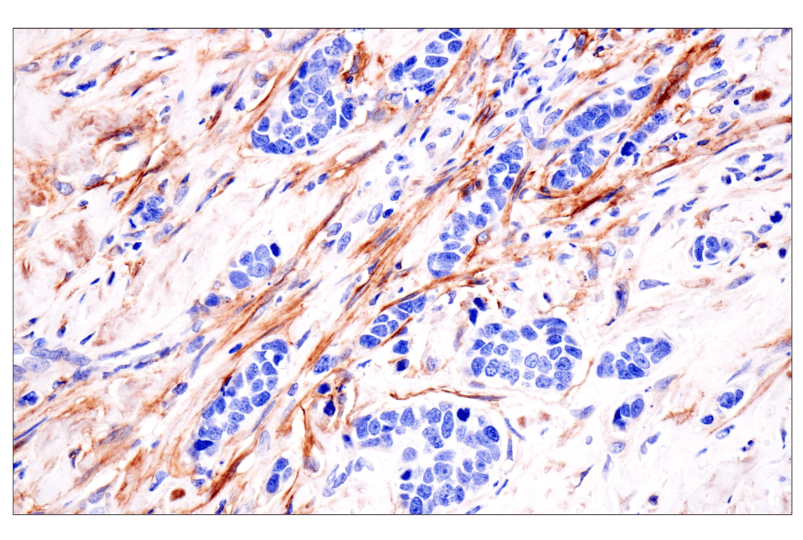 Immunohistochemistry Image 1: LRRC15 (E4X8J) Rabbit Monoclonal Antibody