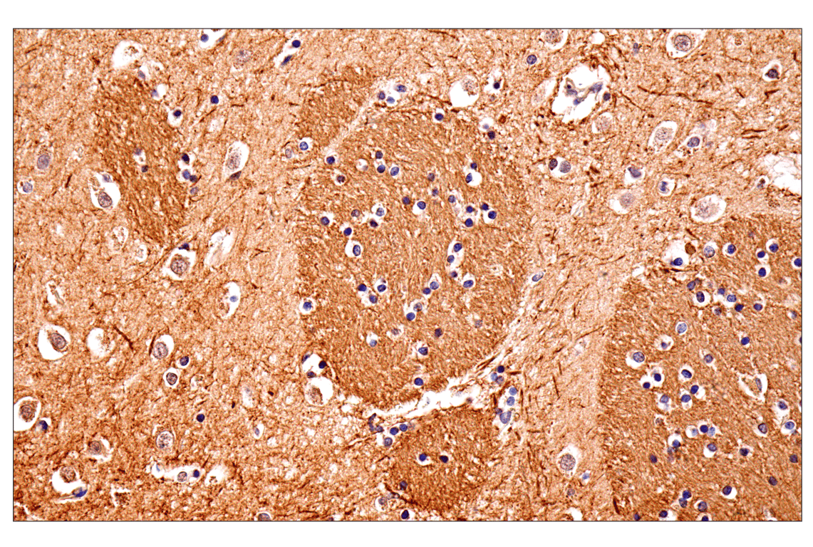 Immunohistochemistry Image 1: Neurofilament-M (E7L2T) Rabbit Monoclonal Antibody (BSA and Azide Free)